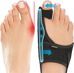2-pack adjustable big toe correctors with soft pads.